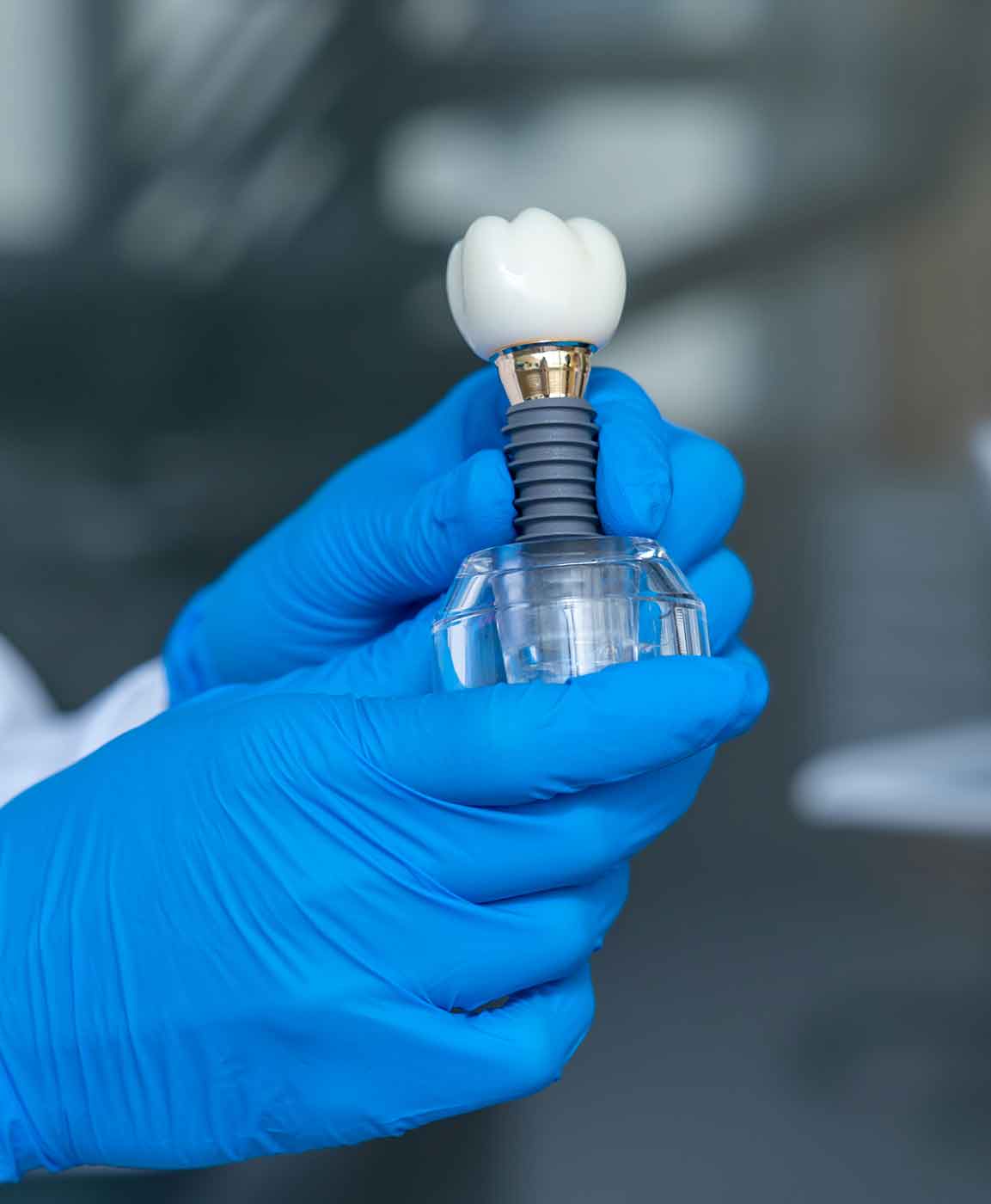 implantes-dentarios-turquia-1