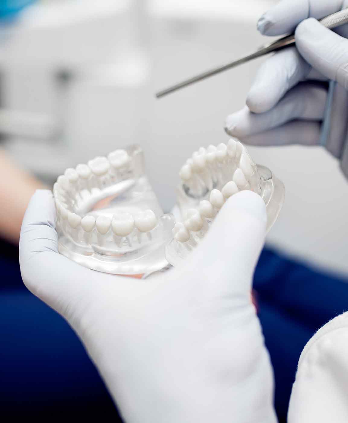 implantes-dentarios-turquia-1