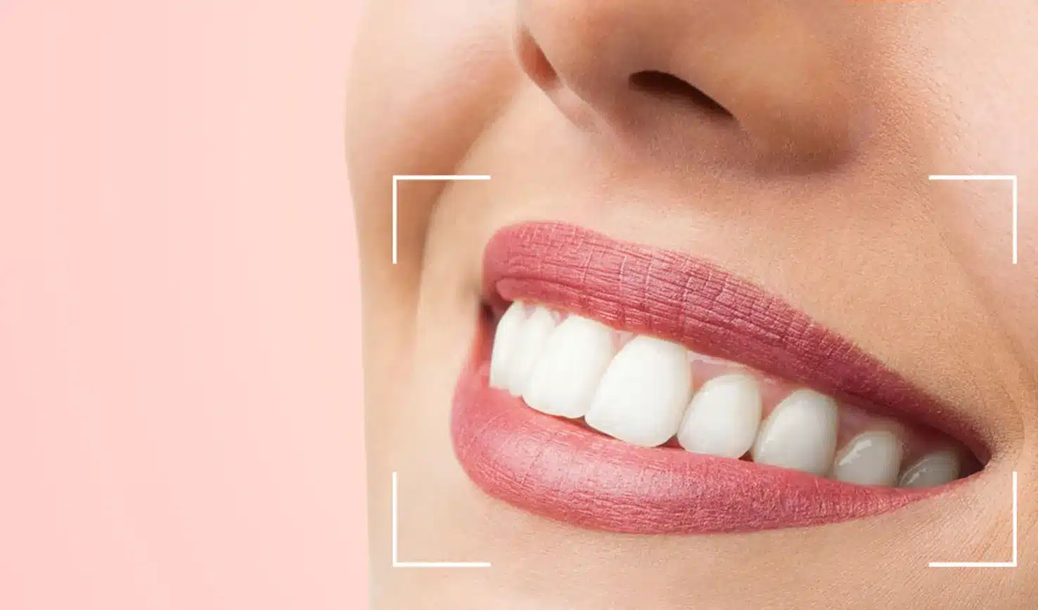 Porcelain vs Zirconia Veneers
