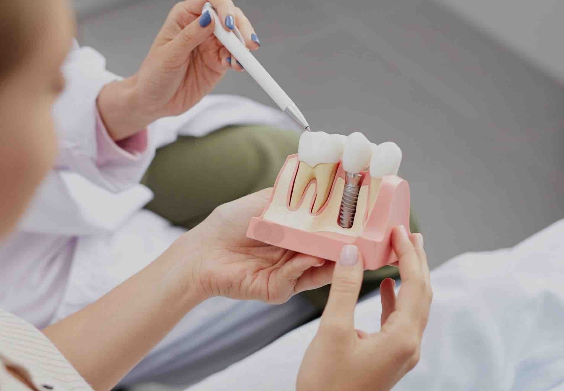 Periodontal Maintenance